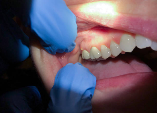 Best Urgent Dental Care for Toothaches in Nashvle, IL